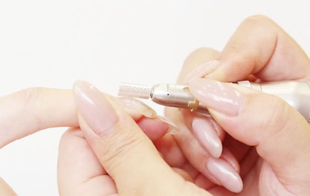 エンドレスフィルイン®